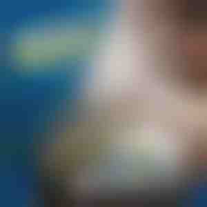 Elektronische reparatie-openingsset | OPTIFIX